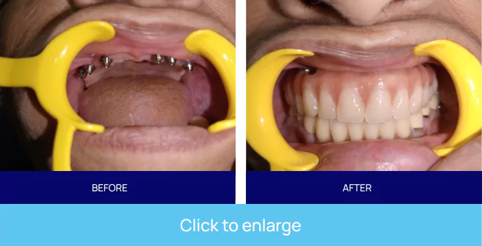 smile gallery